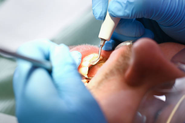 Best After-Hours Dental Trauma Care in Rosedale, WA