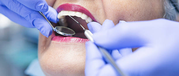 Best Emergency Tooth Extraction in Rosedale, WA